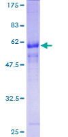 ab162625 on a 12.5% SDS-PAGE stained with Coomassie Blue.