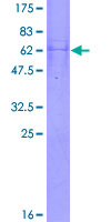 ab160201 on a 12.5% SDS-PAGE stained with Coomassie Blue.