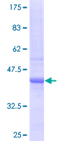 ab163280 on a 12.5% SDS-PAGE stained with Coomassie Blue.