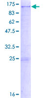 ab163281 on a 12.5% SDS-PAGE stained with Coomassie Blue.