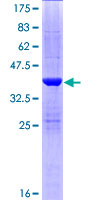 ab162114 on a 12.5% SDS-PAGE stained with Coomassie Blue.