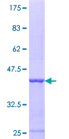 ab162115 on a 12.5% SDS-PAGE stained with Coomassie Blue.