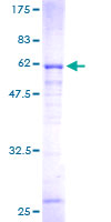 ab161803 on a 12.5% SDS-PAGE stained with Coomassie Blue.