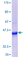 ab161804 on a 12.5% SDS-PAGE stained with Coomassie Blue.
