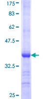 ab159612 on a 12.5% SDS-PAGE stained with Coomassie Blue.