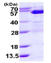 ab113584 at 3 µg analysed by 15% SDS-PAGE.