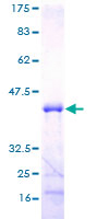 ab160479 on a 12.5% SDS-PAGE stained with Coomassie Blue.