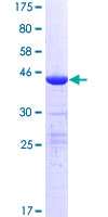 ab159618 on a 12.5% SDS-PAGE stained with Coomassie Blue.