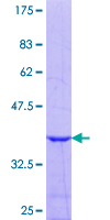 ab159619 on a 12.5% SDS-PAGE stained with Coomassie Blue.