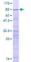 ab159620 on a 12.5% SDS-PAGE stained with Coomassie Blue.