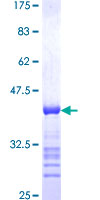 ab159614 on a 12.5% SDS-PAGE stained with Coomassie Blue.