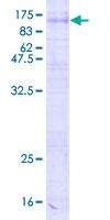 ab161491 on a 12.5% SDS-PAGE stained with Coomassie Blue.