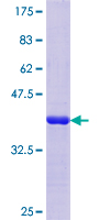 ab161492 on a 12.5% SDS-PAGE stained with Coomassie Blue.