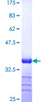 ab161526 on a 12.5% SDS-PAGE stained with Coomassie Blue.