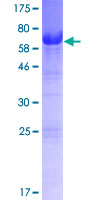 ab164961 on a 12.5% SDS-PAGE stained with Coomassie Blue.