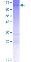 ab164744 on a 12.5% SDS-PAGE stained with Coomassie Blue.