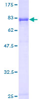 ab159958 on a 12.5% SDS-PAGE stained with Coomassie Blue.