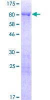 ab159969 on a 12.5% SDS-PAGE stained with Coomassie Blue.