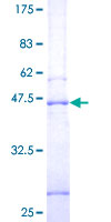 ab160357 on a 12.5% SDS-PAGE stained with Coomassie Blue.