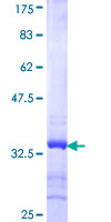ab160356 on a 12.5% SDS-PAGE stained with Coomassie Blue.