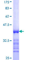 ab152928 on a 12.5% SDS-PAGE stained with Coomassie Blue.