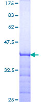 ab161752 on a 12.5% SDS-PAGE stained with Coomassie Blue.