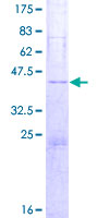 ab166301 on a 12.5% SDS-PAGE stained with Coomassie Blue.