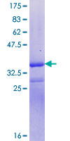 ab152921 on a 12.5% SDS-PAGE stained with Coomassie Blue.