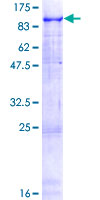 ab160582 on a 12.5% SDS-PAGE stained with Coomassie Blue.