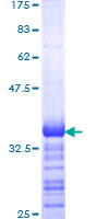 ab160583 on a 12.5% SDS-PAGE stained with Coomassie Blue.