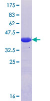 ab161393 on a 12.5% SDS-PAGE stained with Coomassie Blue.