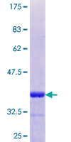ab152906 on a 12.5% SDS-PAGE stained with Coomassie Blue.