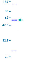 ab160507 on a 12.5% SDS-PAGE stained with Coomassie Blue.