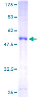 ab166014 on a 12.5% SDS-PAGE stained with Coomassie Blue.