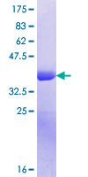ab163596 on a 12.5% SDS-PAGE stained with Coomassie Blue.