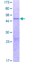 ab164444 on a 12.5% SDS-PAGE stained with Coomassie Blue.