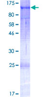 ab166083 on a 12.5% SDS-PAGE stained with Coomassie Blue.