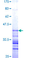 ab153638 on a 12.5% SDS-PAGE stained with Coomassie Blue.