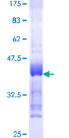 ab153083 on a 12.5% SDS-PAGE stained with Coomassie Blue.