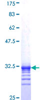 ab159631 on a 12.5% SDS-PAGE stained with Coomassie Blue.