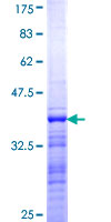 ab159624 on a 12.5% SDS-PAGE stained with Coomassie Blue.