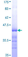 ab159625 on a 12.5% SDS-PAGE stained with Coomassie Blue.