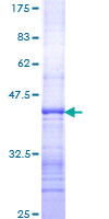 ab159626 on a 12.5% SDS-PAGE stained with Coomassie Blue.