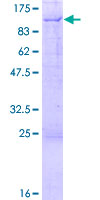 ab159627 on a 12.5% SDS-PAGE stained with Coomassie Blue.