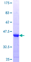 ab159636 on a 12.5% SDS-PAGE stained with Coomassie Blue.