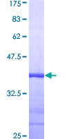 ab160445 on a 12.5% SDS-PAGE stained with Coomassie Blue.