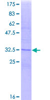 ab152267 on a 12.5% SDS-PAGE stained with Coomassie Blue.