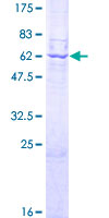ab157835 on a 12.5% SDS-PAGE stained with Coomassie Blue.