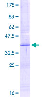 ab157836 on a 12.5% SDS-PAGE stained with Coomassie Blue.