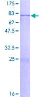 ab162025 on a 12.5% SDS-PAGE stained with Coomassie Blue.